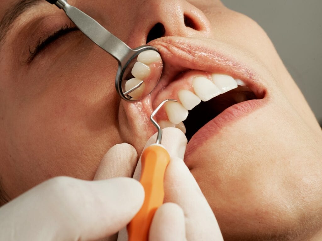 Close-up of a dentist using a mirror and probe to examine a patient's teeth