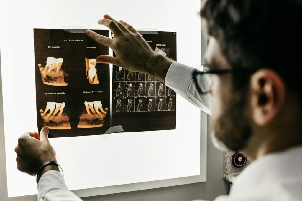 Dentist pointing at 3D dental X-ray scans on a lightbox, analyzing tooth structure